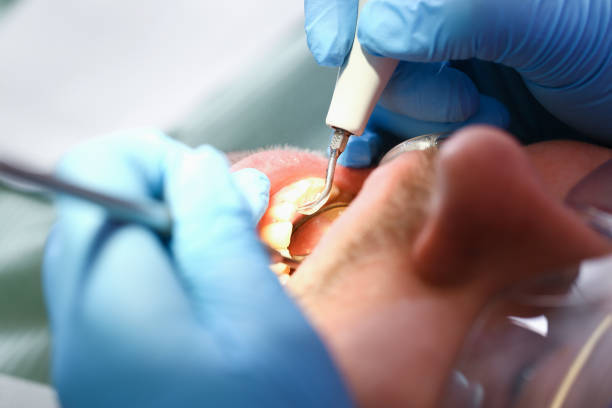 Best Emergency Dental Surgery in New Braunfels, TX